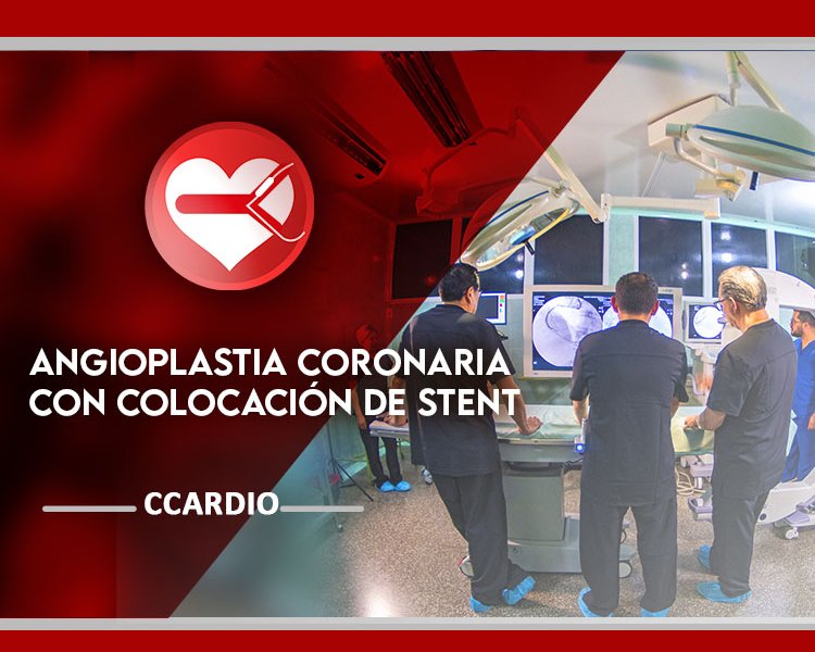 Angioplastia coronaria con colocación de Stent