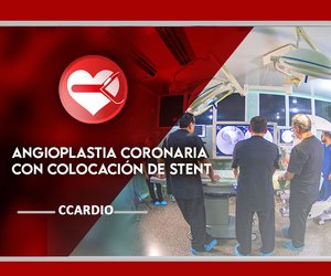 Angioplastia coronaria con colocación de Stent