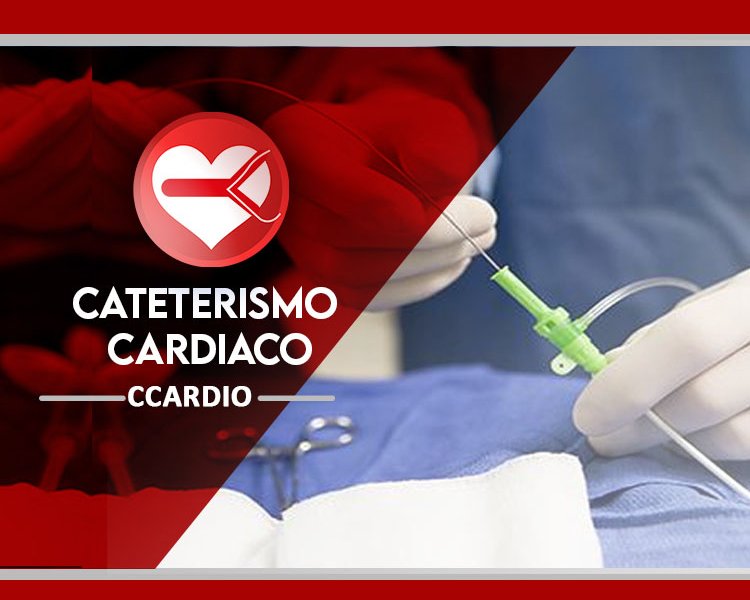 Cateterismo cardiaco