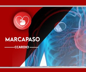 Marcapaso