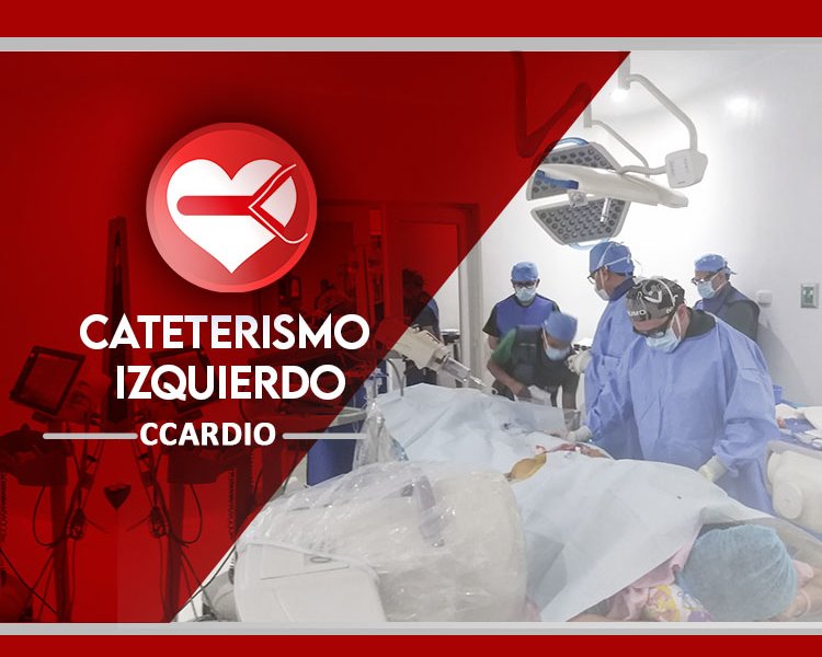 cateterismo izquierdo