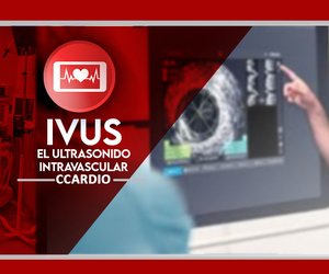 ivus